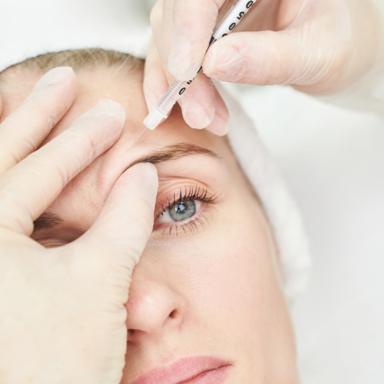 Derma Filler Treatments 2