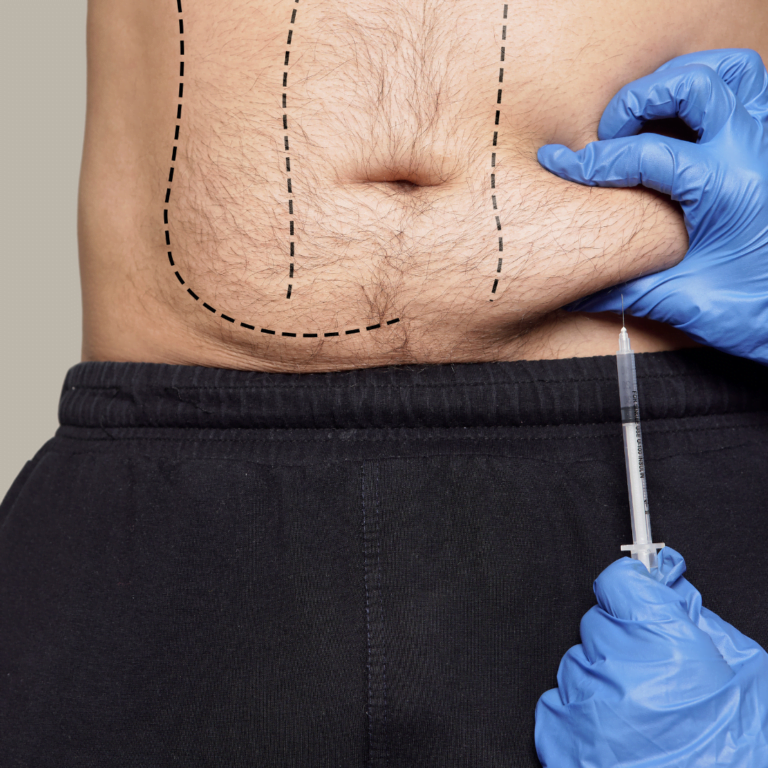 Fat Dissolving Injection