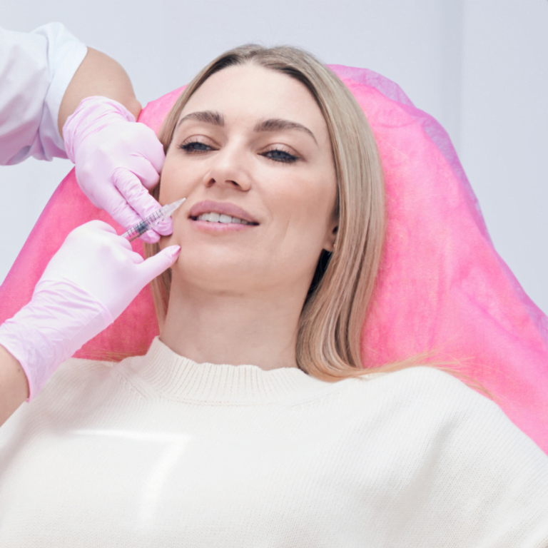 Marionette Smile Lines1