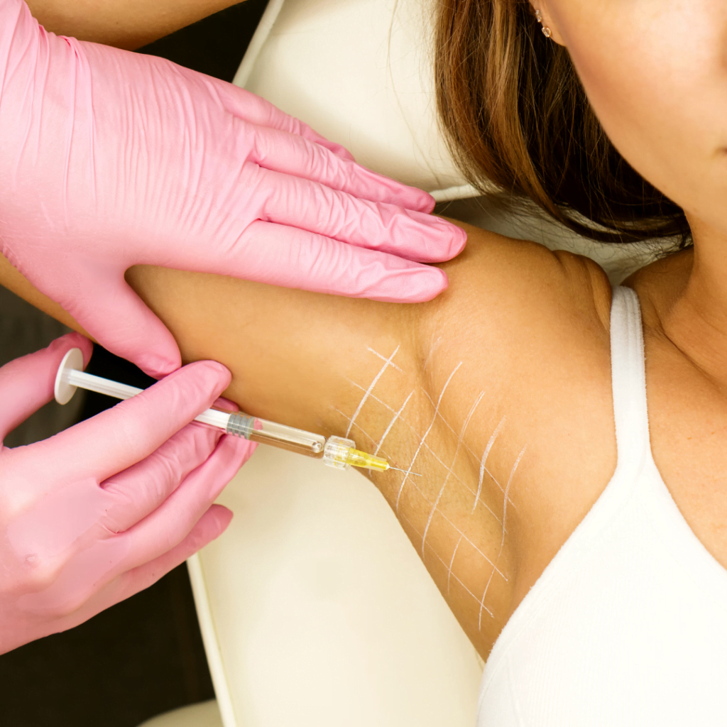 Hyperhidrosis botox treatment